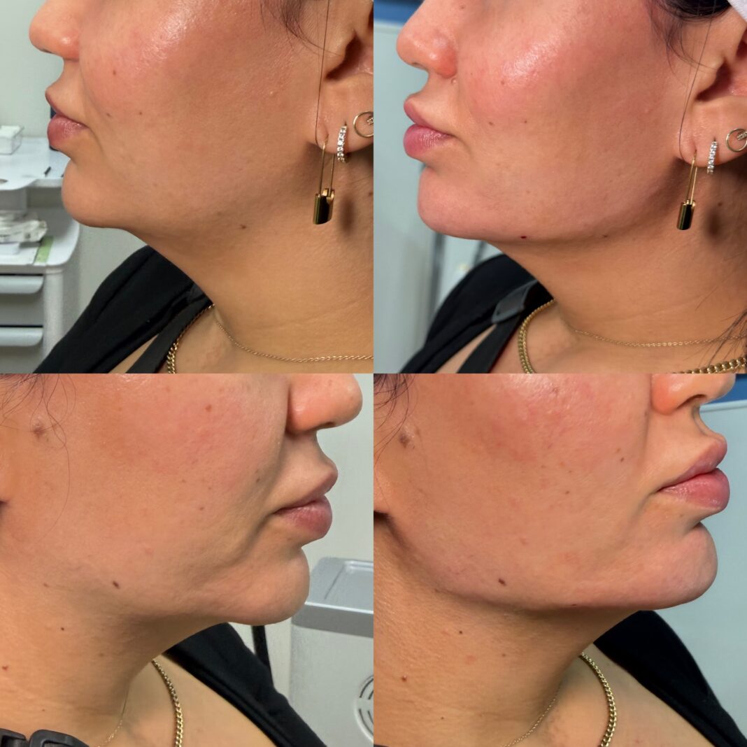 Achieve Flawless Skin with Eternia Medspa’s Cutting-Edge Aesthetic Solutions